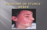 Sindrome de Sturge - Weber