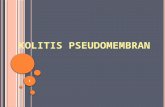Blok 10 Sken 4 Pseudomembranous Colitis
