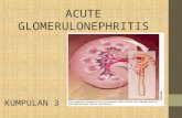 Acute gromerulonephritis