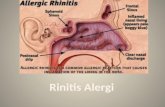 KELOMPOK 1 Rhinitis Alergi Update.pptx