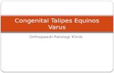Congenital Talipes Equinos Varus MKDU rev.pptx