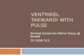 Ventrikel Takikardi With Pulse