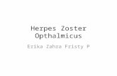 Herpes Zooster Opthalmica