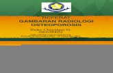 Gambaran Radiologi Osteoporosis dr. Pherena Amalia, Sp. Rad