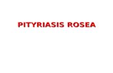 Pityriasis Rosea Dm