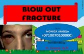 141667523 Blowout Fraktur