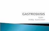 Gastroskisis Powerpoint