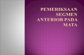 Pemeriksaan Segmen Anterior Pada Mata.pptx Fe&Sopi