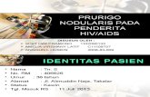 Prurigo Nodularis Pd Penderita HIV-AIDS
