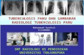 Gambaran Radiologi TB Paru