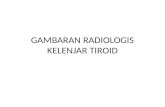 Gambaran Radiologis Kelenjar Tiroid