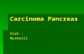 Carcinoma Pancreas