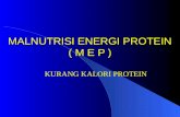 Malnutrisi Energi Protein