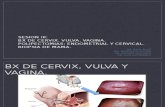 Sesion III Bx de Cervix