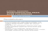 akne fulminans (jurnal reading)