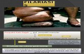 Filariasis s