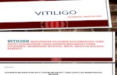 Vitiligo penyakit kulit