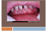 9. Manifestasi Penyakit Sistemik Dalam Mulut