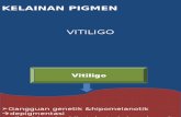 Kelainan Pigmen(Vitiligo)