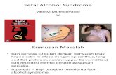 Fetal Alcohol Syndrome.pptx