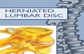 Herniated Lumbar Disc 2006