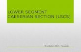 LOWER SEGMENT CAESERIAN SECTION (LSCS)