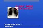 X-RAY DADA - (SISTEM RESPIRASI)