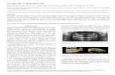 2D and 3D: A Hidden Truth - OMICS Publishing Group · PDF file2D and 3D: A Hidden Truth Shaifulizan Abdul Rahman1, Mohammad Khursheed Alam2, Nor Fatiyah Che M Nasir3 1Oral and Maxillofacial